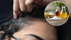 Jakie są zalety stosowania octu i sody oczyszczonej w walce z siwizną i jak to robić prawidłowo?